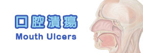 口腔潰瘍Mouth Ulcers