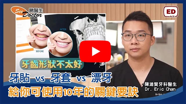 牙貼 vs 牙套 vs 漂牙 | 給你可使用10年的關鍵要訣
