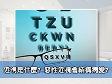 近視是什麼? 惡性近視會結構病變?