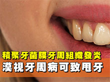 漠視牙周病可致甩牙