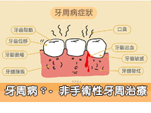 牙周病 -  非手術性牙周治療