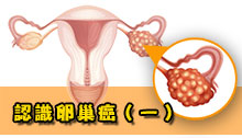 【守護女性健康】- 認識卵巢癌（一）