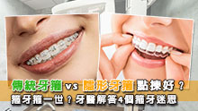 傳統牙箍vs隱形牙箍點揀好？箍牙箍一世？牙醫解答4個箍牙迷思