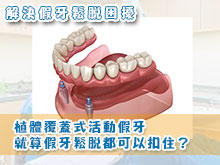 植體覆蓋式活動假牙 就算假牙鬆脫都可以扣住？解決假牙鬆脫困擾