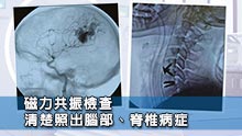 磁力共振檢查 清楚照出腦部、脊椎病症