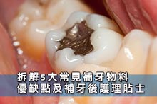 拆解5大常見補牙物料優缺點及補牙後護理貼士