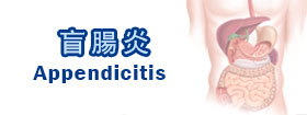 盲腸炎Appendicitis