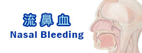 流鼻血Nasal bleeding