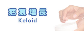 疤痕增長Keloid