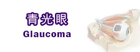 青光眼Glaucoma