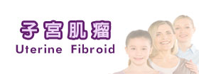 子宮肌瘤Uterine Fibroid