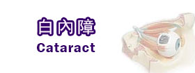 白內障Cataract