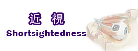 近視shortsightedness