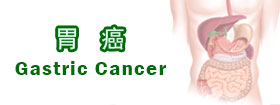 胃癌Gastric Cancer