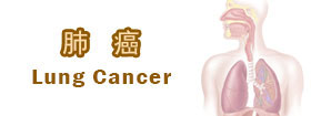 肺癌Lung Cancer