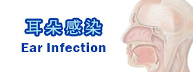 耳朵感染Ear Infection