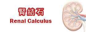 腎結石Renal Calculus