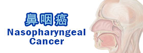 鼻咽癌Nasopharyngeal Cancer