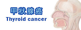 甲狀腺癌Thyroid cancer