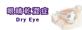 眼睛乾澀症Dry Eye