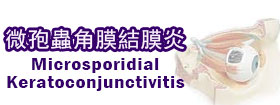 微孢蟲角膜結膜炎 Microsporidial keratoconjunctivitis  