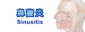 鼻竇炎Sinusitis