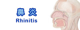 鼻炎Rhinitis