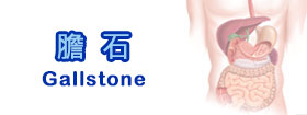 膽石Gallstone