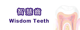 智慧齒Wisdom Teeth