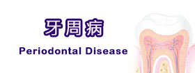 牙周病Periodontal Disease