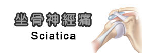 坐骨神經痛Sciatica