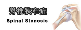 脊椎狹窄症Spinal Stenosis