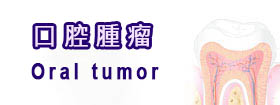 口腔腫瘤Oral tumor