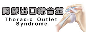 胸廓出口綜合症Thoracic Outlet Syndrome