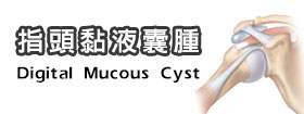 指頭黏液囊腫Digital Mucous Cyst