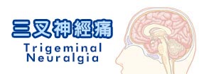 三叉神經痛Trigeminal Neuralgia