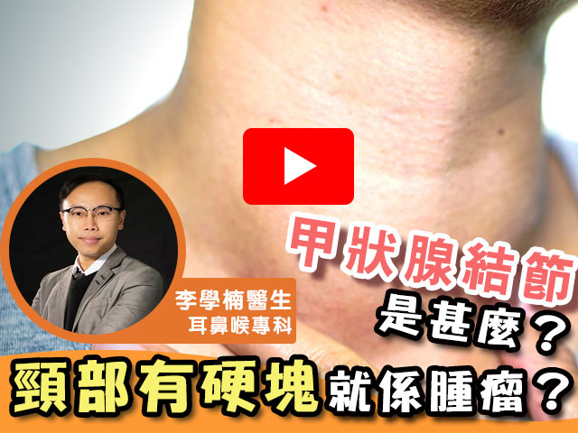 甲狀腺結節是甚麼？頸部有硬塊就係腫瘤？ 