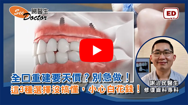 全口重建要天價？ 別急做！這3種選擇沒搞懂，小心白花錢！