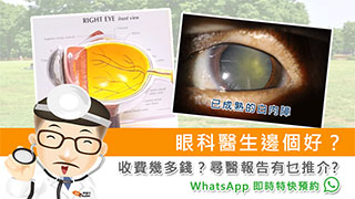 眼科醫生邊個好?