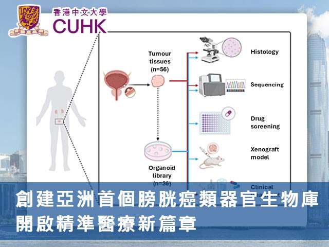中大醫學院創建亞洲首個膀胱癌類器官生物庫 開啟精準醫療新篇章