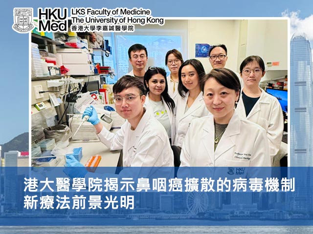 港大醫學院揭示鼻咽癌擴散的病毒機制 新療法前景光明