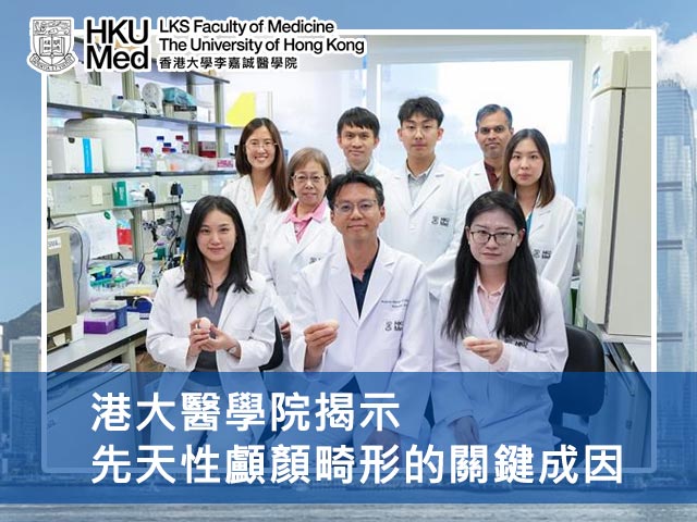 港大醫學院揭示先天性顱顏畸形的關鍵成因
