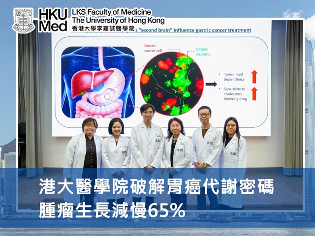港大醫學院破解胃癌代謝密碼，腫瘤生長減慢65%