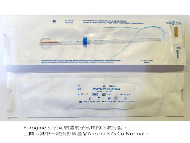 回收Eurogine SL子宮環