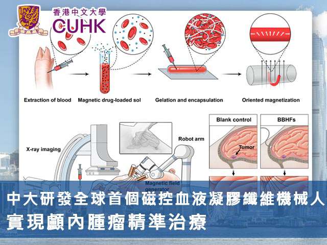 中大研發全球首個磁控血液凝膠機械人 實現顱內腫瘤精準治療