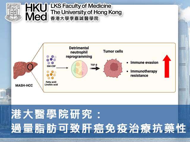 港大醫學院研究:過量脂肪可致肝癌免疫治療抗藥性
